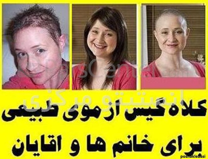 مدل های کلاه گیس زنانه