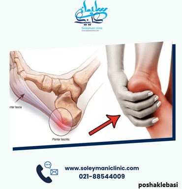 مدل کفش برای خار پاشنه