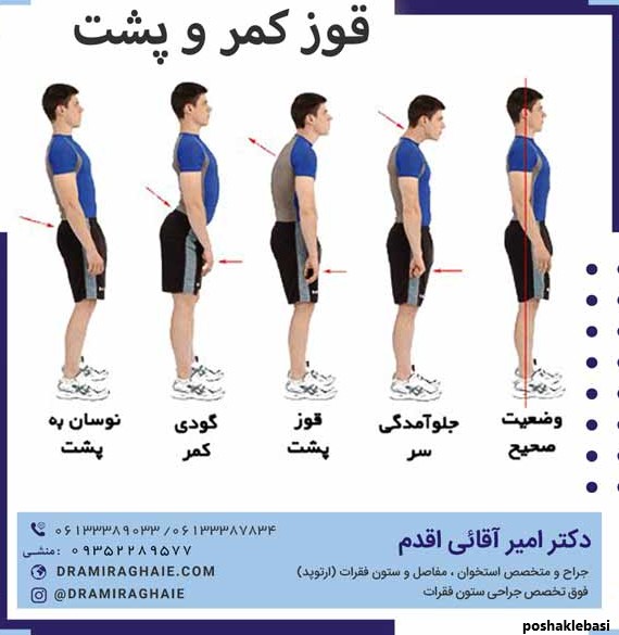 مدل لباس برای کسانی که گودی کمر دارند